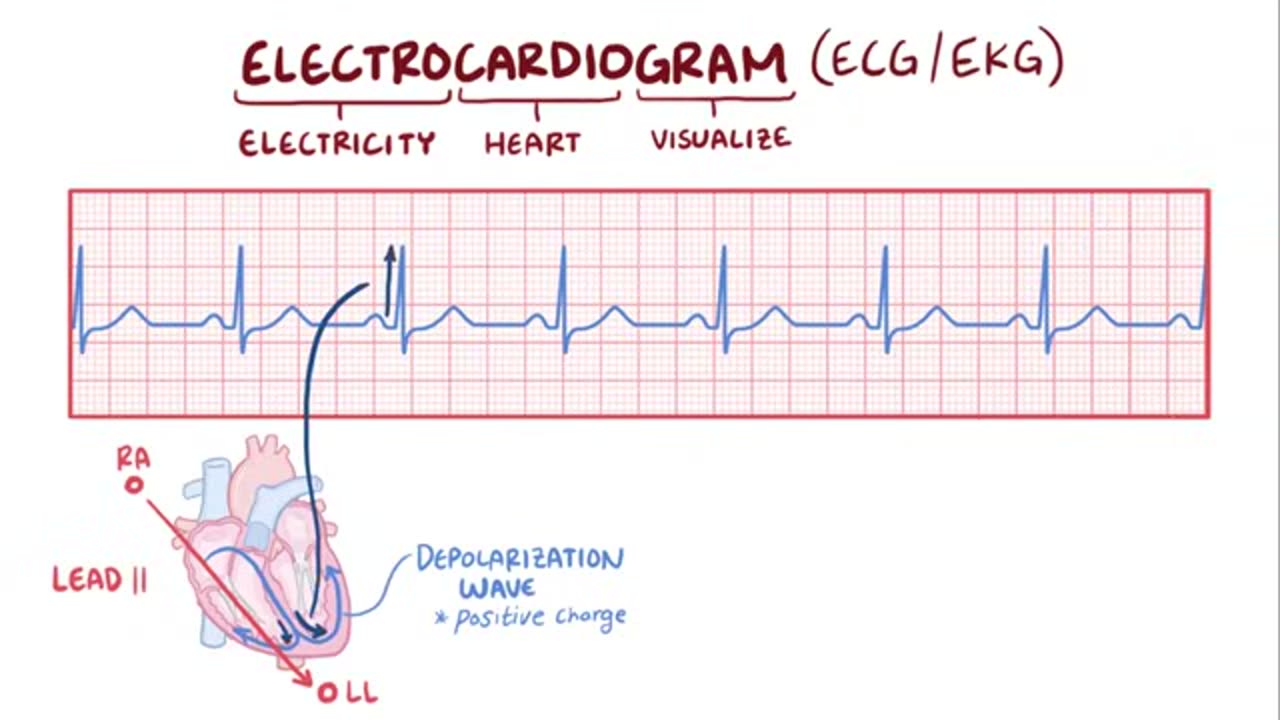 Electrocardiography (ECG/EKG) - basics