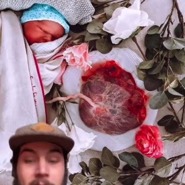 “They cut those cords KNOWING they are jam packed full of stem cells!