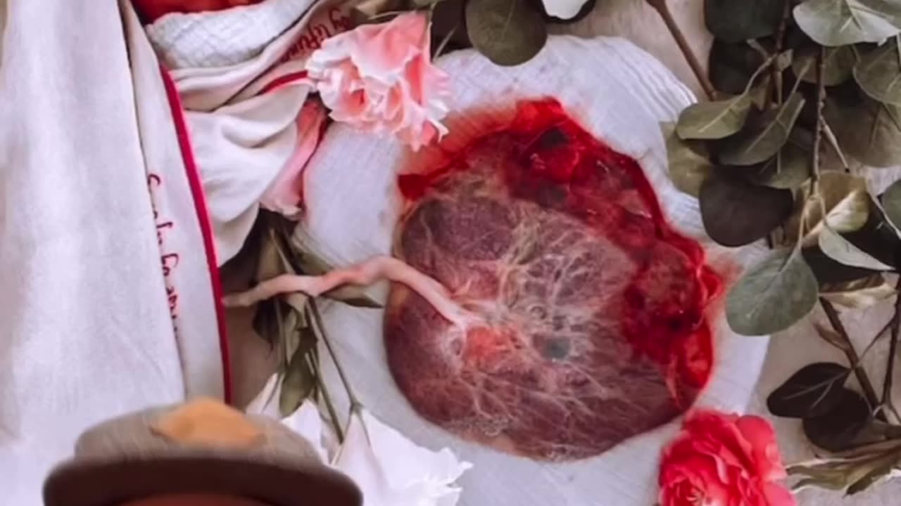 “They cut those cords KNOWING they are jam packed full of stem cells!