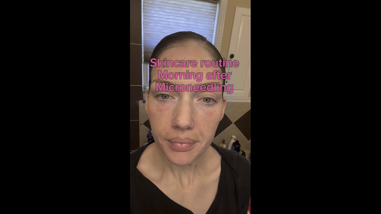 Morning after microneedling skincare