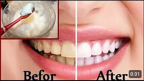 How to clean teeth