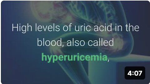 How to Lower Uric Acid Naturally
