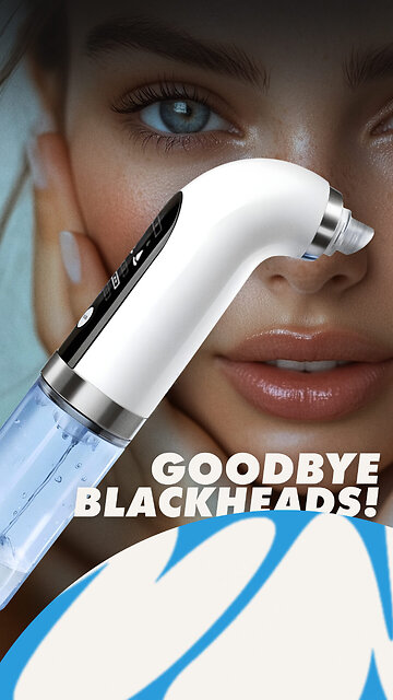 Electric Blackhead Remover