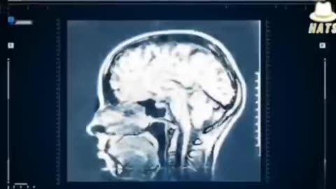 STUDY CONDUCTED IN 1983 RELEASED TO THE PUBLIC IN 2003