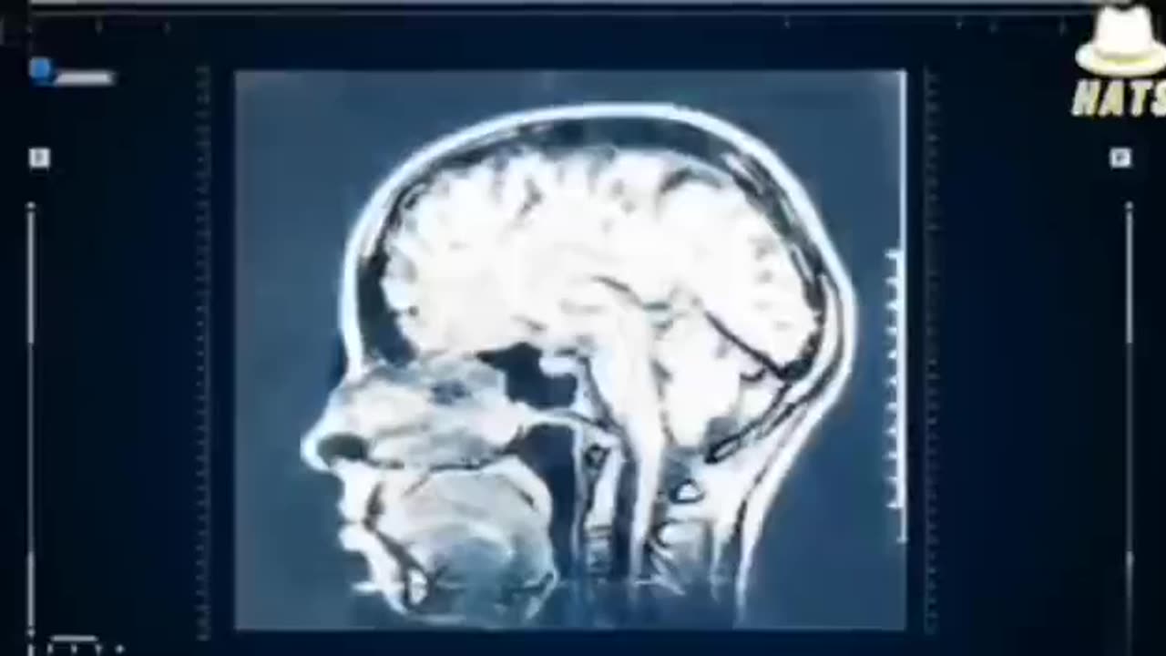 STUDY CONDUCTED IN 1983 RELEASED TO THE PUBLIC IN 2003