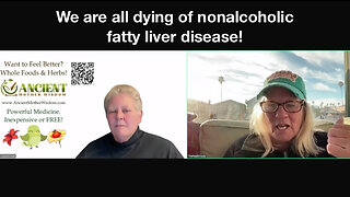 We are all dying of nonalcoholic fatty liver disease