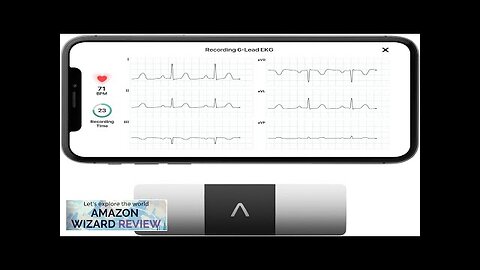 KardiaMobile 6-Lead Personal EKG Monitor – Six Views of The Heart – Review