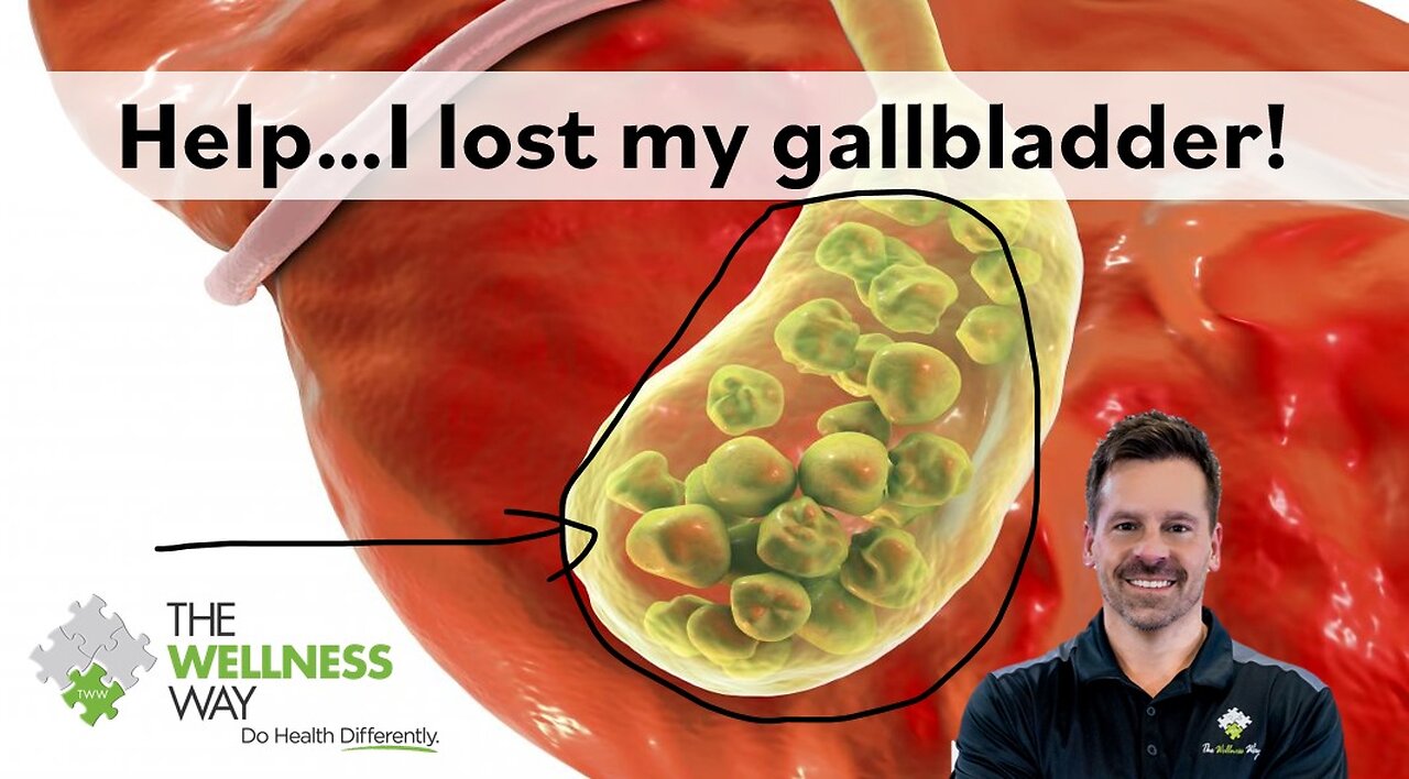 Help! I lost my gallbladder!