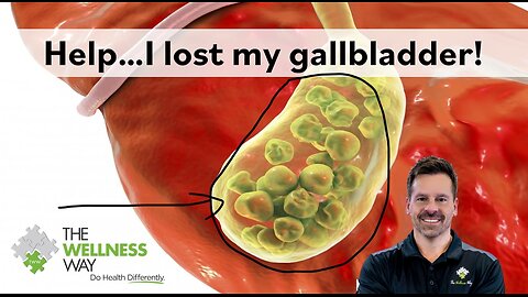 Help! I lost my gallbladder!