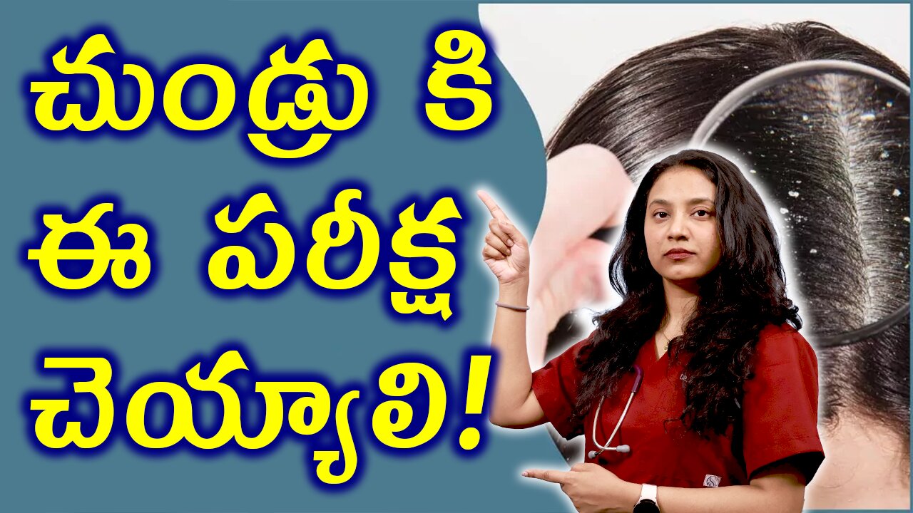 చుండ్రు కి ఈ పరీక్ష చెయ్యాలి Tests and investigations for Dandruff Treatment Cure | హోమియోపతి