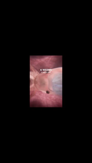 Don't miss the first moment a baby's brain is detected