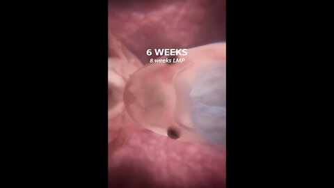 Don't miss the first moment a baby's brain is detected