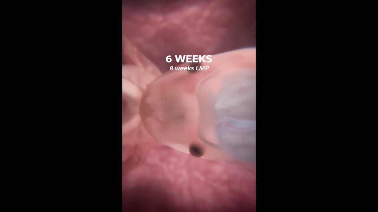 Don't miss the first moment a baby's brain is detected