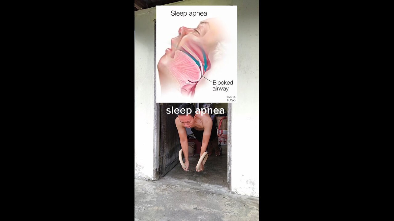 what is sleep apnea? explain fast!