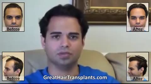 Dr. Brett Bolton Transforms Military Man’s Hair with MaxHarvest™