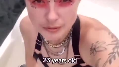 Gender dysphoria - a social contagion