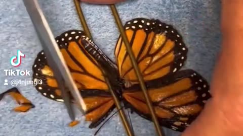 🦋👨‍⚕️ Mind-Blowing Butterfly Surgery You Need to See! | FeedMyCuriosity