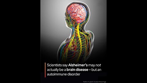 🧠 Alzheimer’s may not be caused by brain decay but the immune system misfiring. A bold new theory