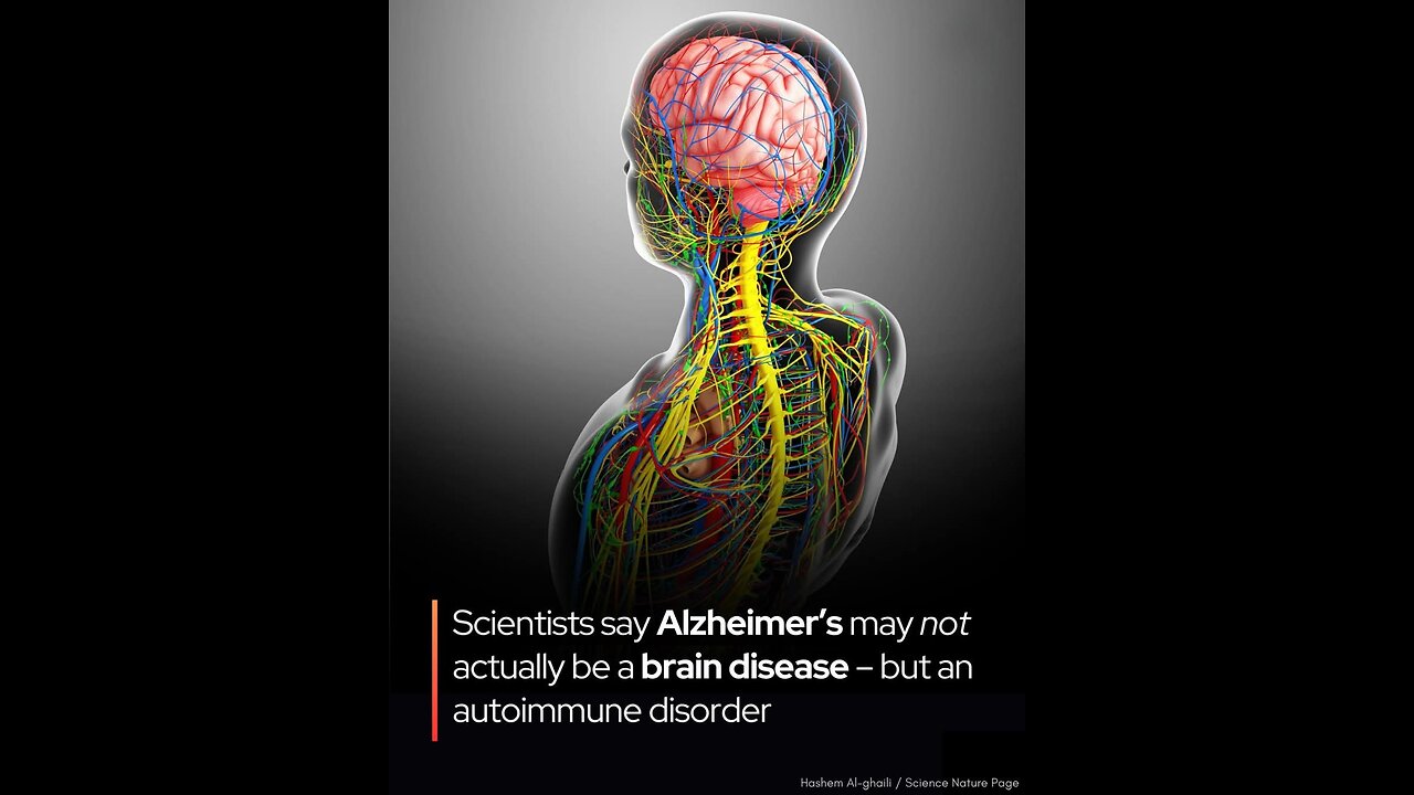 🧠Alzheimer’s may not be caused by brain decay but the immune system misfiring. A bold new theory