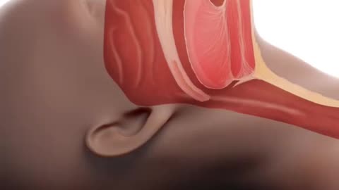 What Happens During Sleep Apnea (3D Animation)
