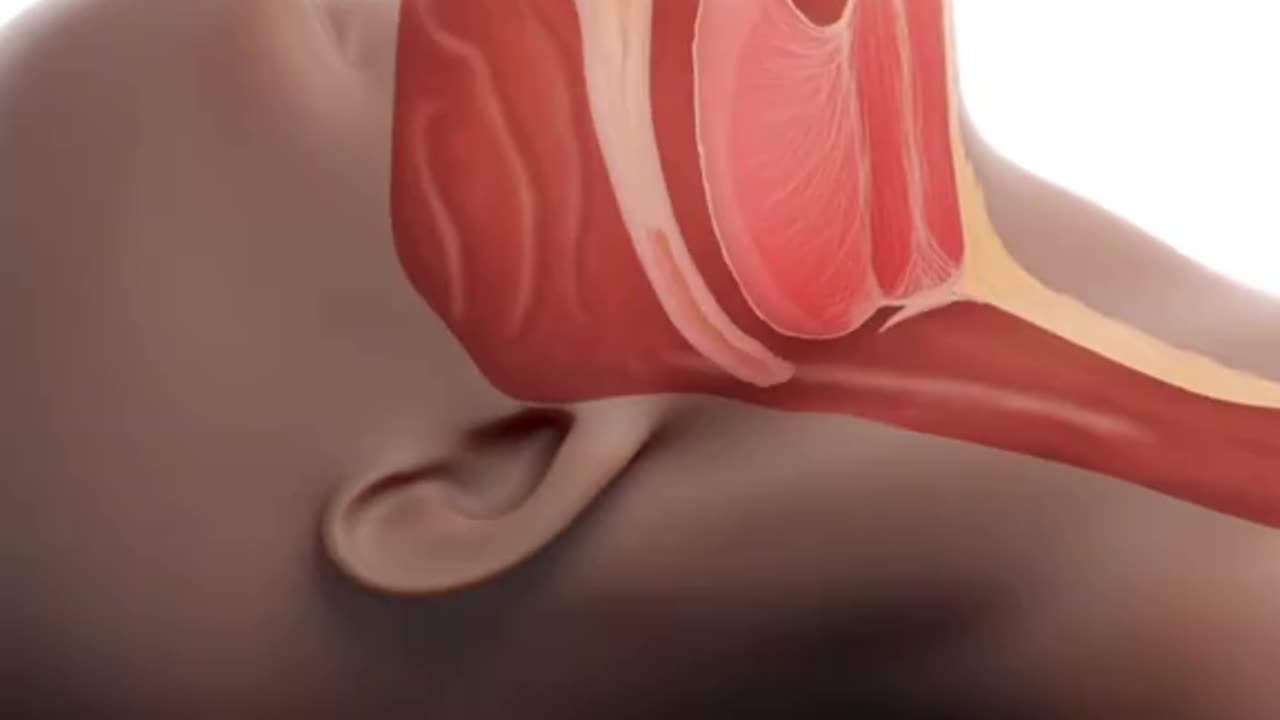 What Happens During Sleep Apnea (3D Animation)