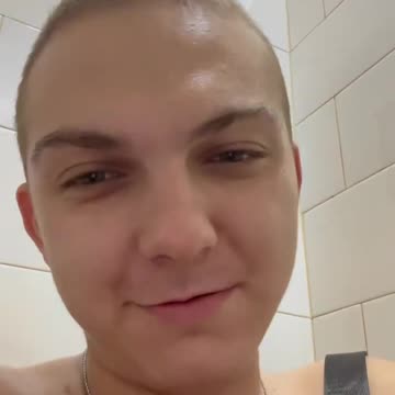 Discharged Russian Soldier is Happy to Still Be Alive and Kicking..., Well... Alive at Least.