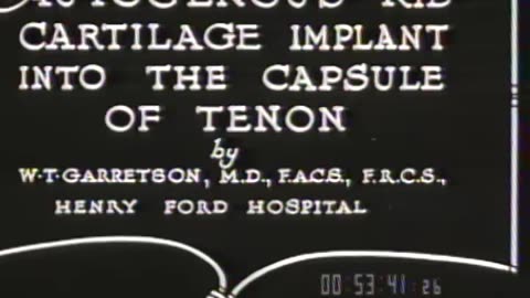Autogenous Rib Cartil... - Autogenous Rib Cartilage Implant into the Capsule of Tenon b - fc-fc-1081