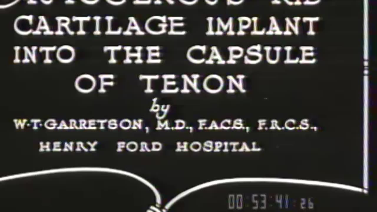 Autogenous Rib Cartil... - Autogenous Rib Cartilage Implant into the Capsule of Tenon b - fc-fc-1081