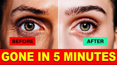 Get Rid of Puffy Eyes in 5 Minutes with This Simple Trick!