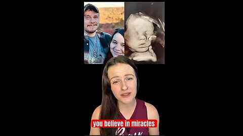 Hand of God 🙏 Appears on Baby’s Head in Ultrasound