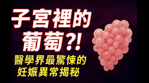 子宮裡的‘葡萄’：懷孕竟能變這樣？！醫學真相大揭秘｜The Shocking Truth： Molar Pregnancy: When Pregnancy Turns into ‘Grapes’