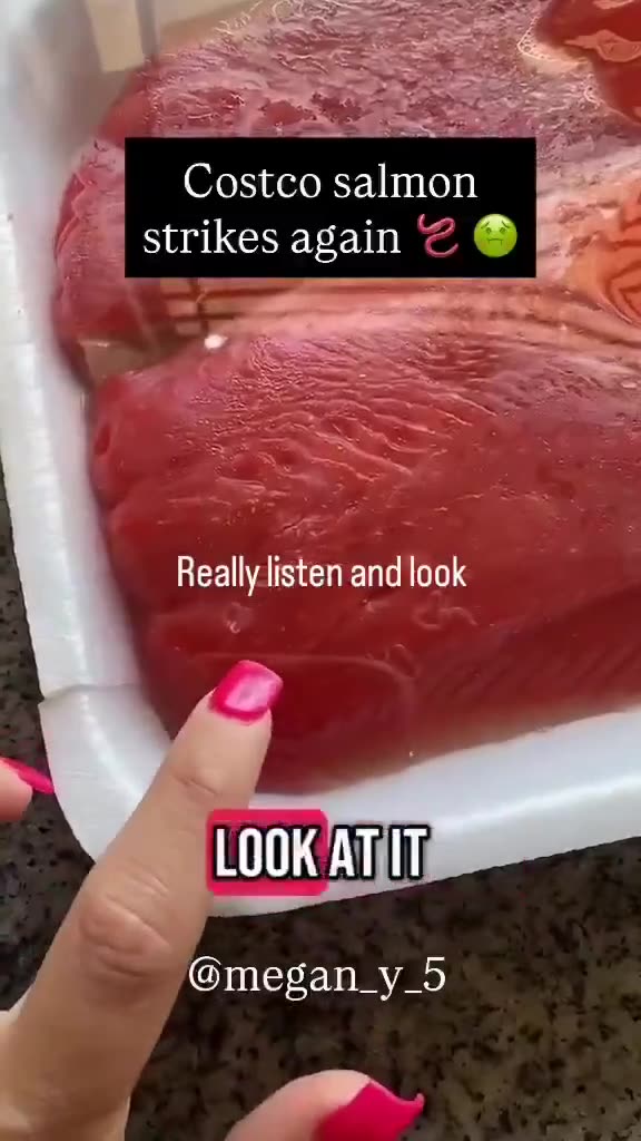American Woman buys a salmon steak from Costco and claims it’s riddled with parasites.