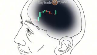 This Is My Brain All Day 🤯 | Trading Life