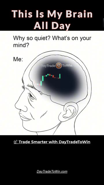 This Is My Brain All Day 🤯 | Trading Life