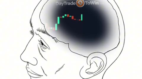 This Is My Brain All Day 🤯 | Trading Life