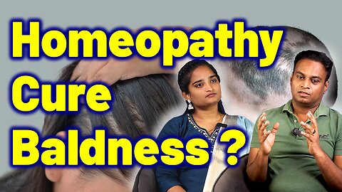 How Baldness is Treated With Homeopathy ? | Alopecia Treatment Cure Relief Medicine | Skin Hair Nail