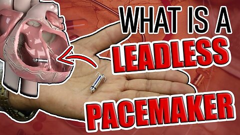 What is a Leadless Pacemaker?