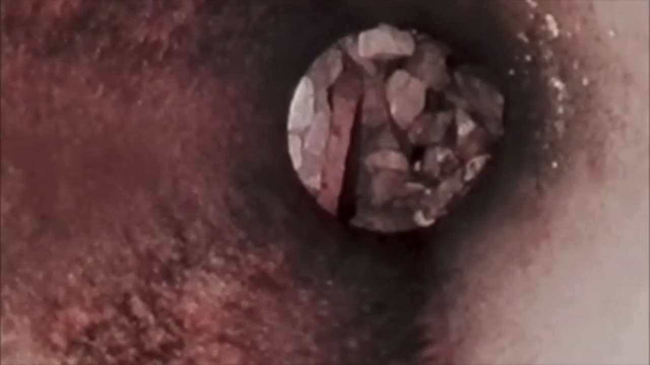 Collapsed Sewer