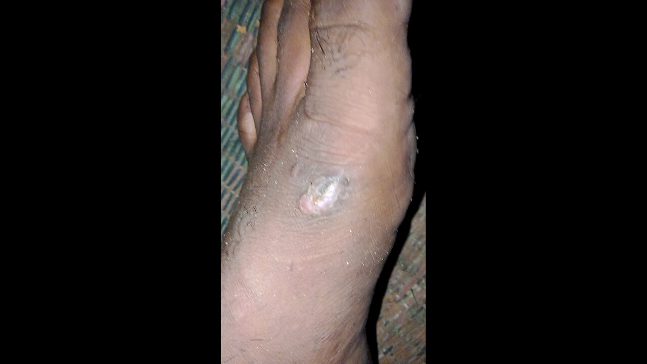 my help please