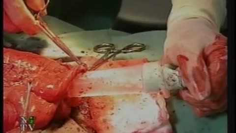 Bol'nitca Vseh Svyatiyih NTV September 12, 2001 925am-1015am MSD