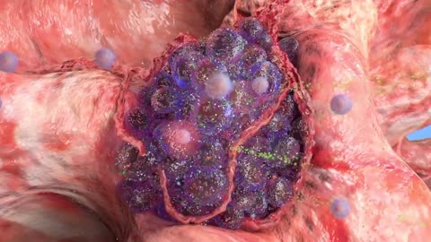 Treatment Compilation - Metabolic Therapies that are Saving Lives