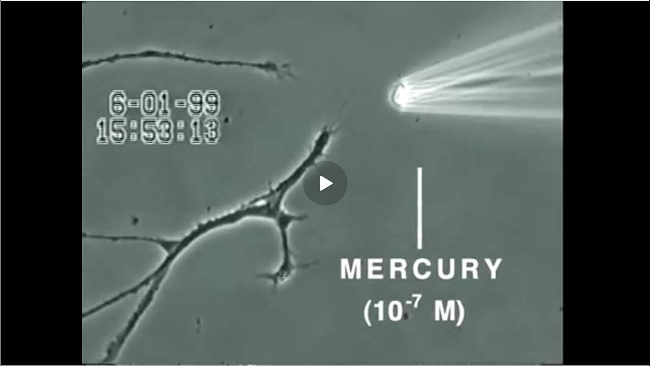 How Mercury Causes Brain Neuron Damage