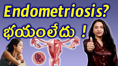 ఎండోమెట్రియోసిస్ కి భయంలేదు Trusted Treatment for Endometriosis or Endometrial implants | హోమియోపతి