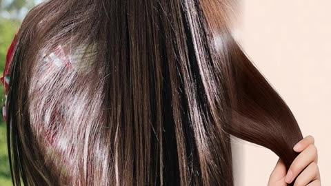 सर्दियों में आंवला खाने के चार ज़बरदस्त फायदेhealth #trend #short #facts #viral #reels