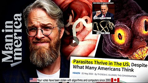The DISTURBING Truth About Parasites — Live Q&A w/ Dr. Jason Dean