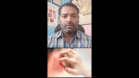 त्वचा,बाल,नाखून की बीमारियों का इलाज किस डॉक्टर से कराएं ।