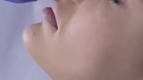 Balloon Angioplasty Procedure Is Done