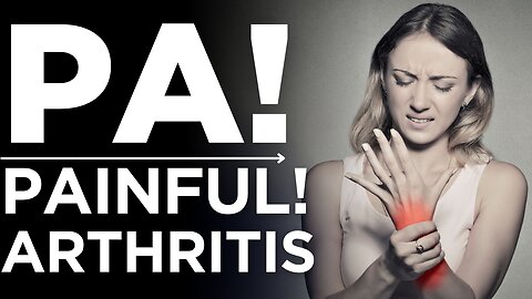 Arthritis Relief: Powerful Techniques Everyone Must Try | Medickpidia
