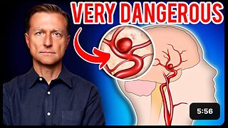Aneurysms: The Silent Killer