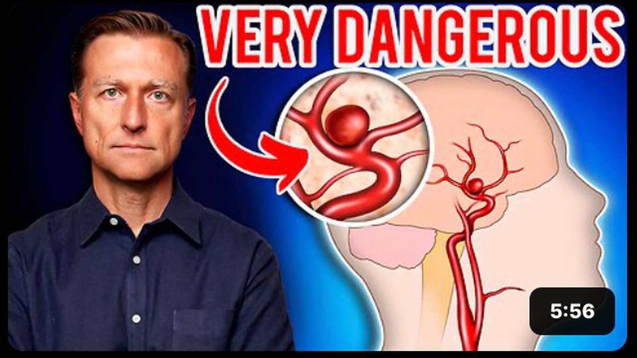 Aneurysms: The Silent Killer